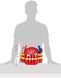 Игровой набор рюкзак врача с аксессуарами Rescue Backpack Theo Klein 4314